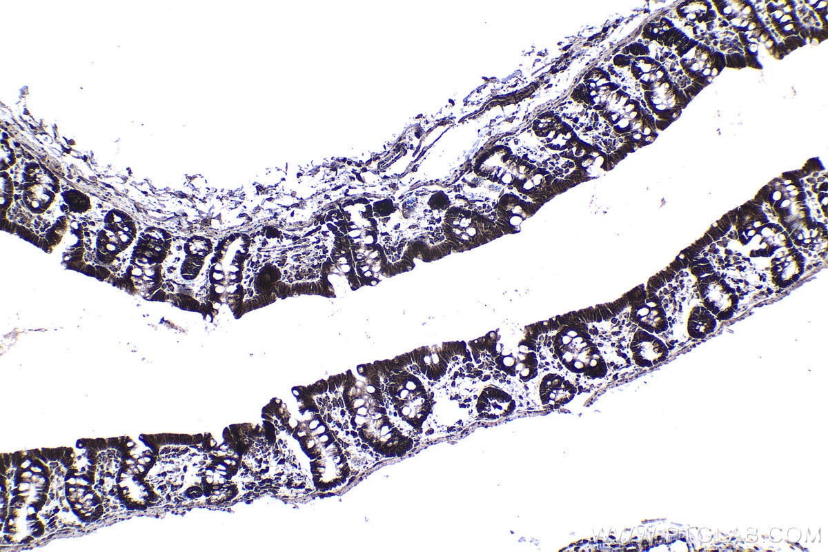 Immunohistochemical analysis of paraffin-embedded rat colon tissue slide using KHC1366 (MTDH IHC Kit).