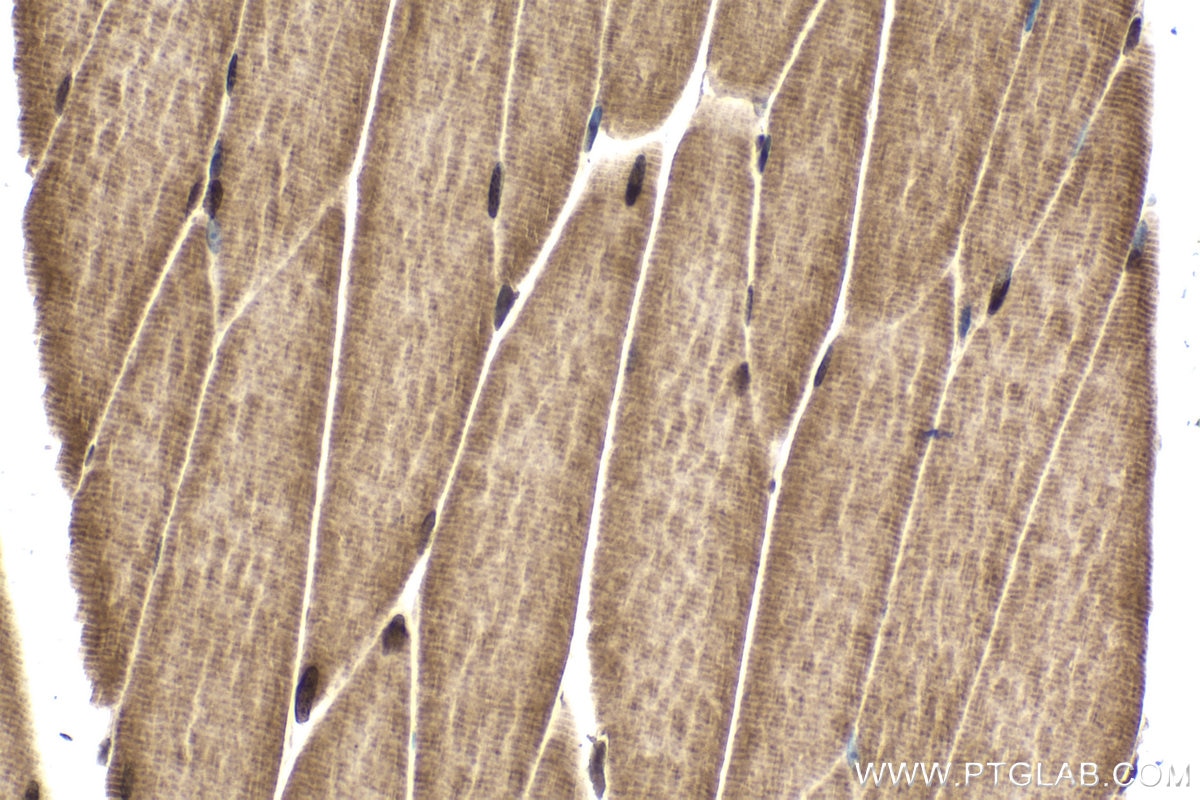 Immunohistochemical analysis of paraffin-embedded mouse skeletal muscle tissue slide using KHC1738 (MTF1 IHC Kit).