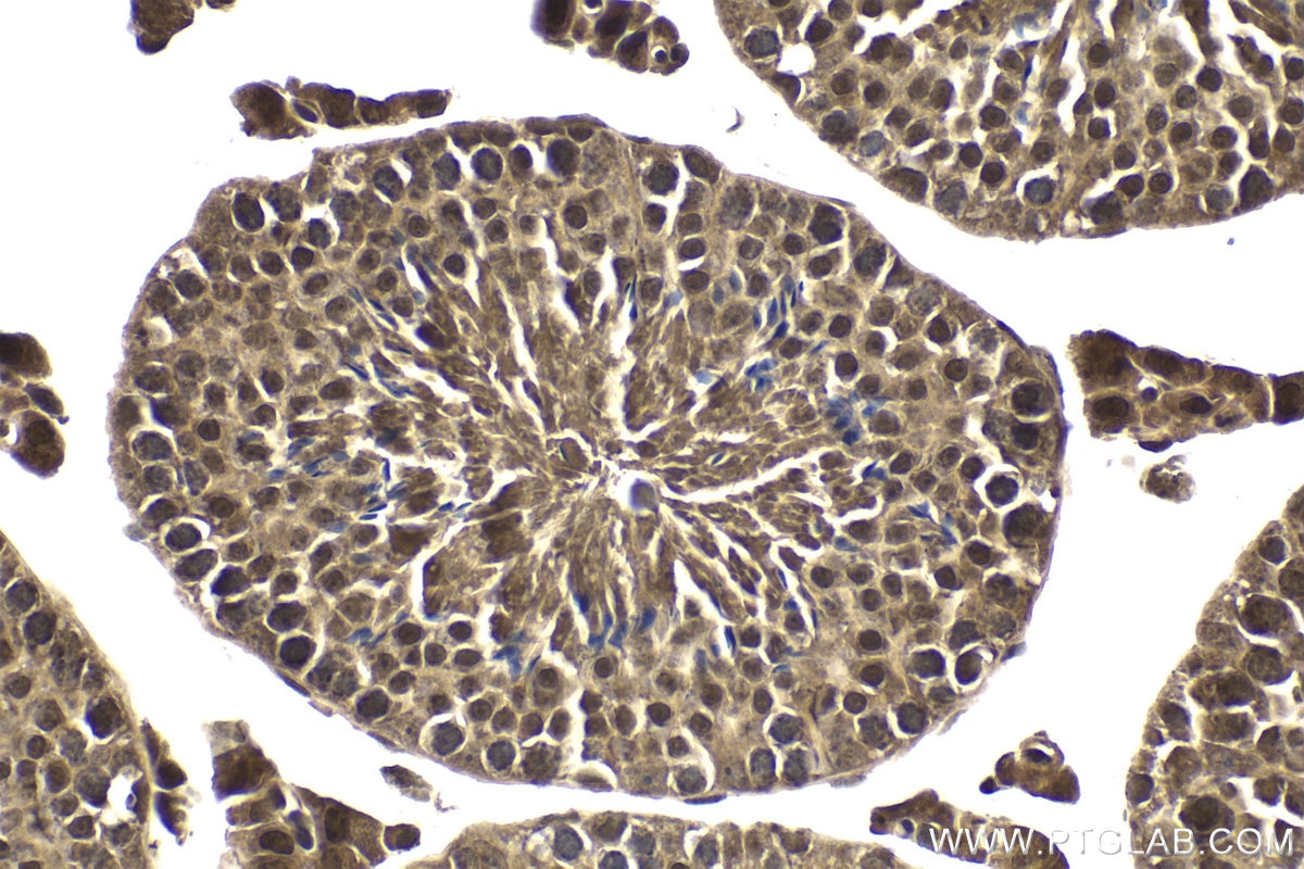 Immunohistochemical analysis of paraffin-embedded mouse testis tissue slide using KHC1738 (MTF1 IHC Kit).