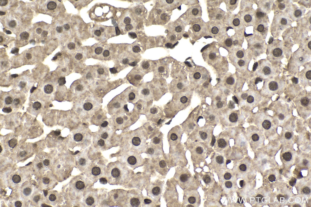 Immunohistochemical analysis of paraffin-embedded rat liver tissue slide using KHC1738 (MTF1 IHC Kit).