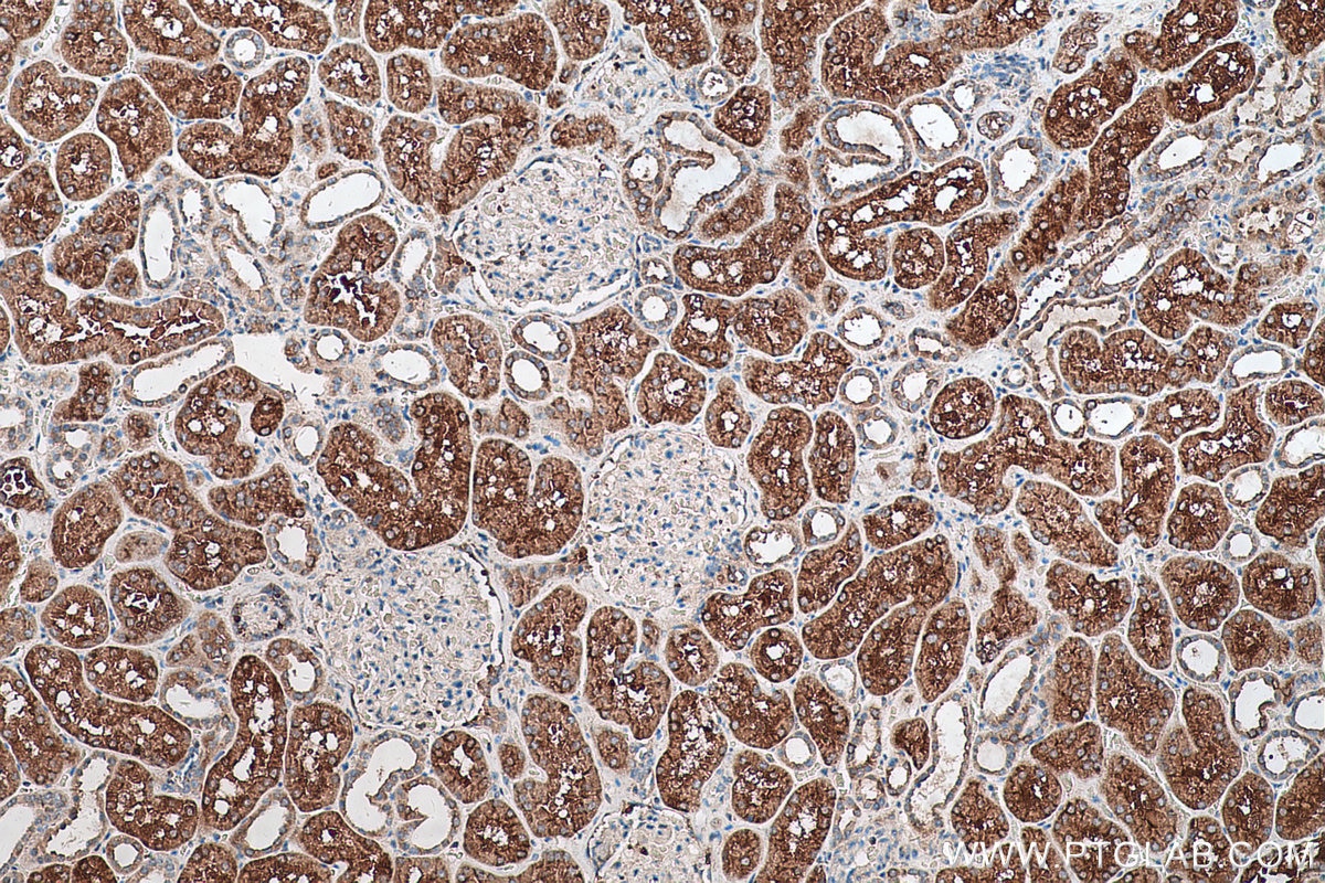 Immunohistochemical analysis of paraffin-embedded human kidney tissue slide using KHC0578 (MTHFD1 IHC Kit).