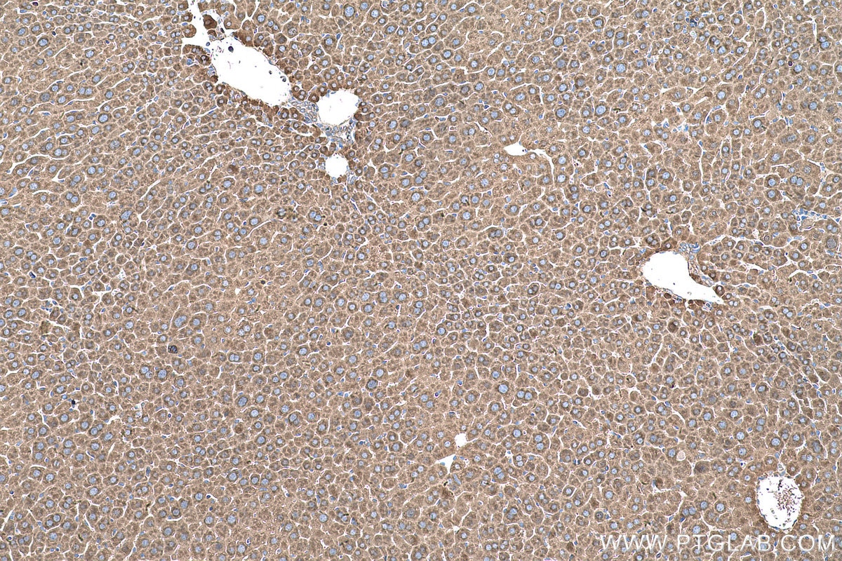 Immunohistochemical analysis of paraffin-embedded mouse liver tissue slide using KHC0578 (MTHFD1 IHC Kit).