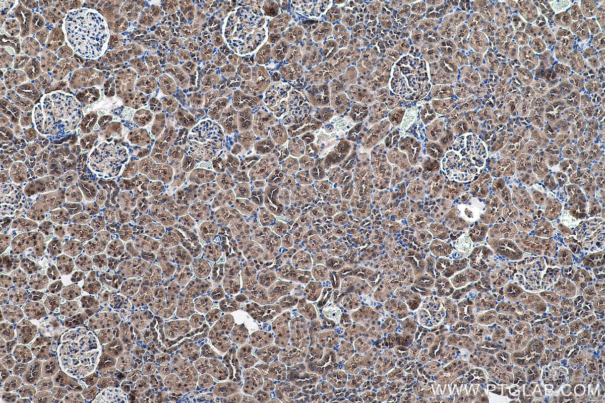 Immunohistochemical analysis of paraffin-embedded rat kidney tissue slide using KHC0578 (MTHFD1 IHC Kit).