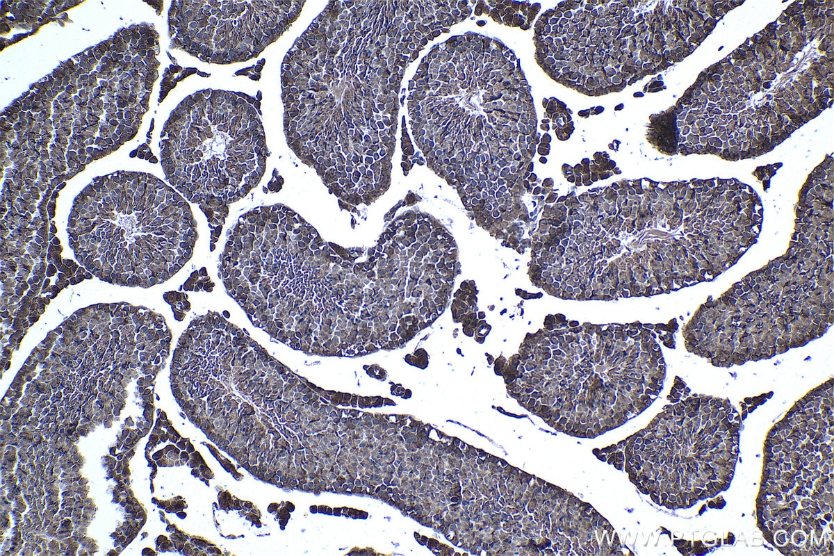 Immunohistochemical analysis of paraffin-embedded mouse testis tissue slide using KHC0974 (MTHFD2 IHC Kit).