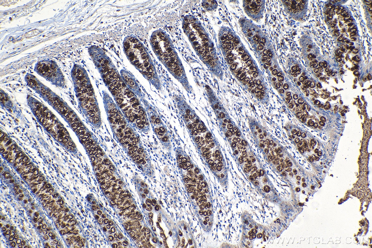 Immunohistochemical analysis of paraffin-embedded human colon tissue slide using KHC1327 (MUC2 IHC Kit).