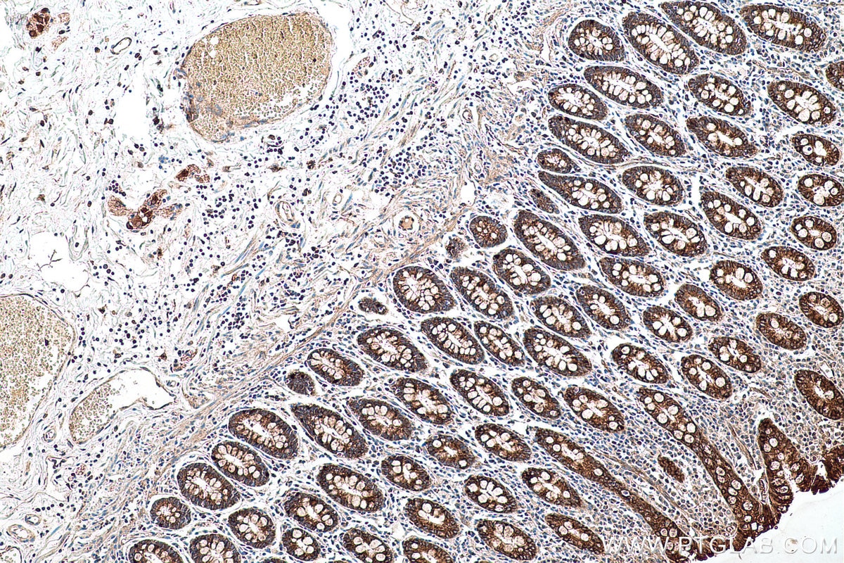 Immunohistochemical analysis of paraffin-embedded human colon tissue slide using KHC0603 (MUC4 IHC Kit).