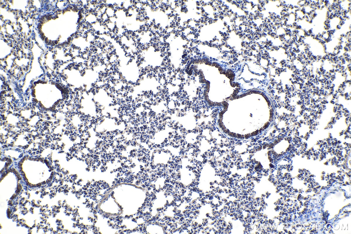 Immunohistochemical analysis of paraffin-embedded mouse lung tissue slide using KHC1093 (MUC5B IHC Kit).