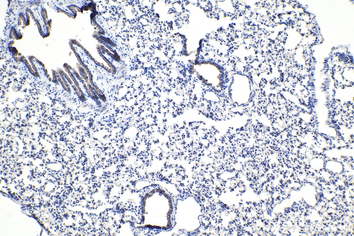Immunohistochemical analysis of paraffin-embedded rat lung tissue slide using KHC1093 (MUC5B IHC Kit).