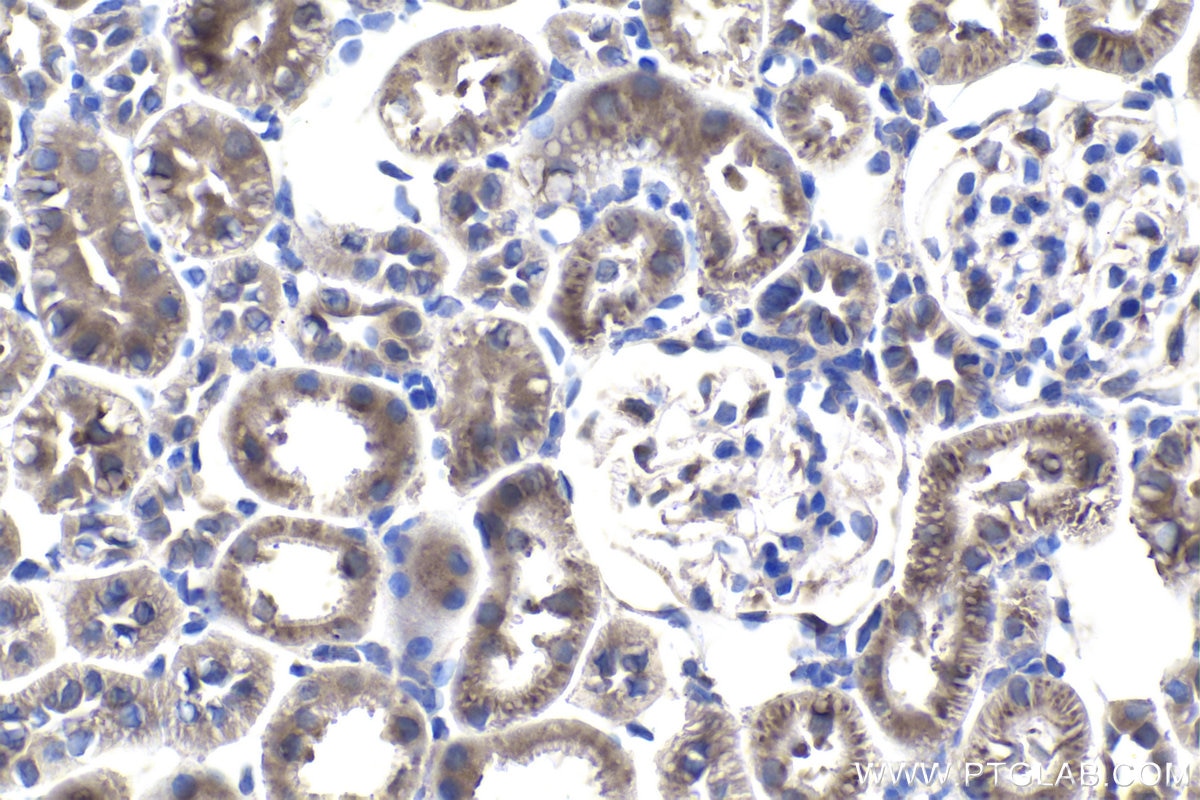 Immunohistochemical analysis of paraffin-embedded rat kidney tissue slide using KHC1021 (MUT IHC Kit).