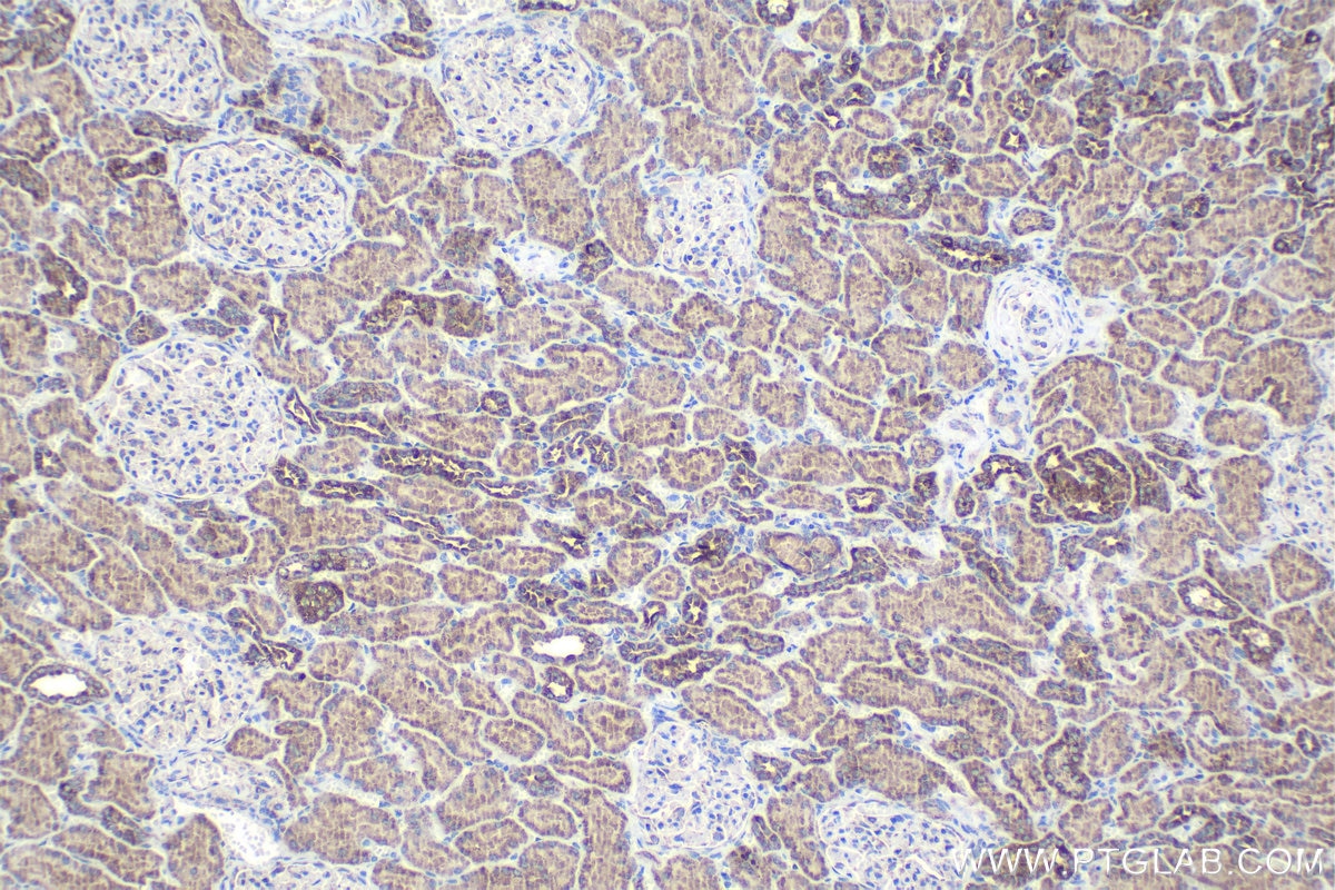 Immunohistochemical analysis of paraffin-embedded human kidney tissue slide using KHC1021 (MUT IHC Kit).