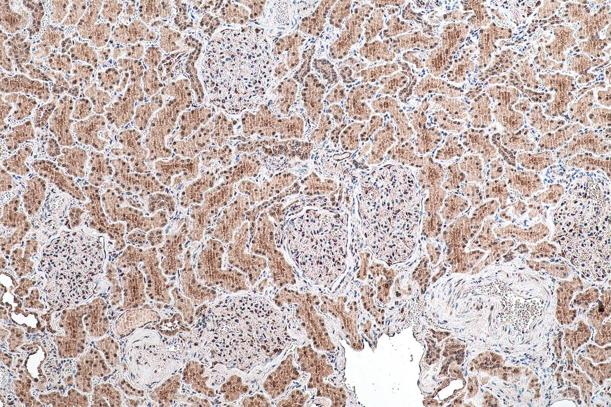 Immunohistochemical analysis of paraffin-embedded human kidney tissue slide using KHC1011 (MYBBP1A IHC Kit).