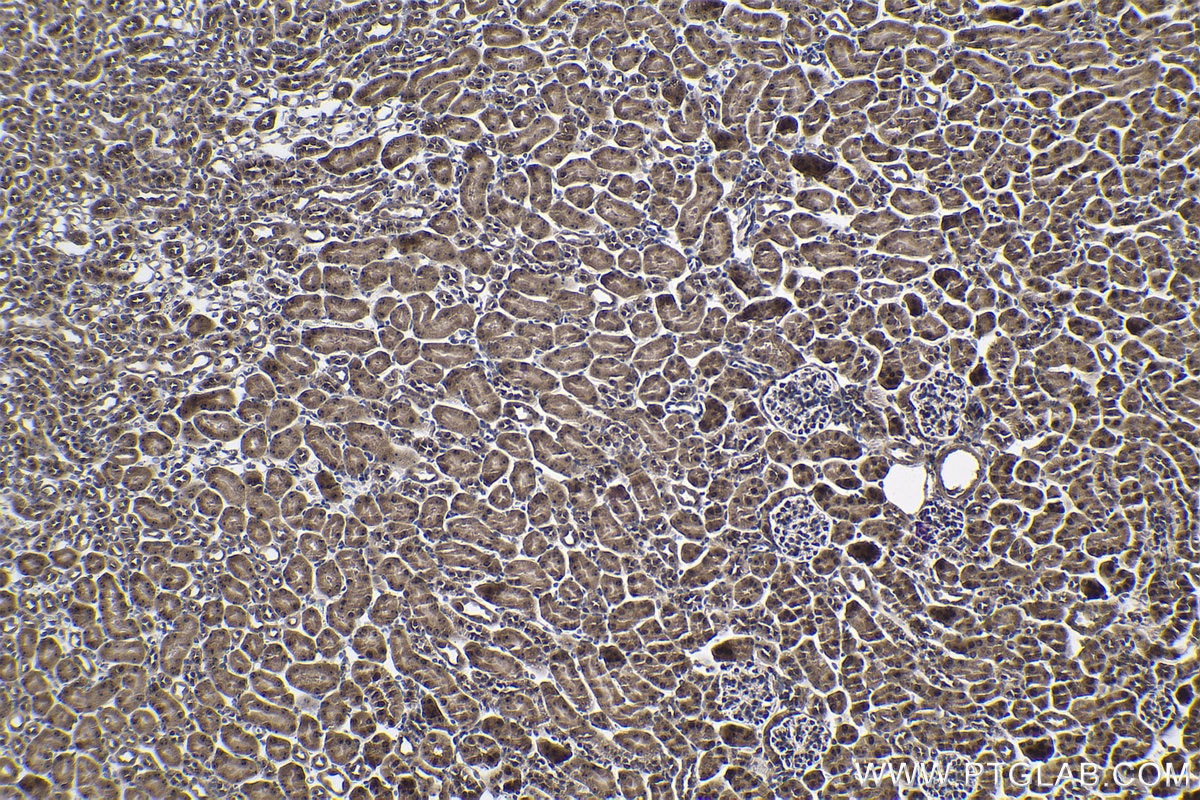 Immunohistochemical analysis of paraffin-embedded mouse kidney tissue slide using KHC1011 (MYBBP1A IHC Kit).