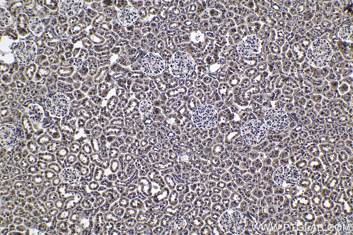 Immunohistochemical analysis of paraffin-embedded rat kidney tissue slide using KHC1011 (MYBBP1A IHC Kit).