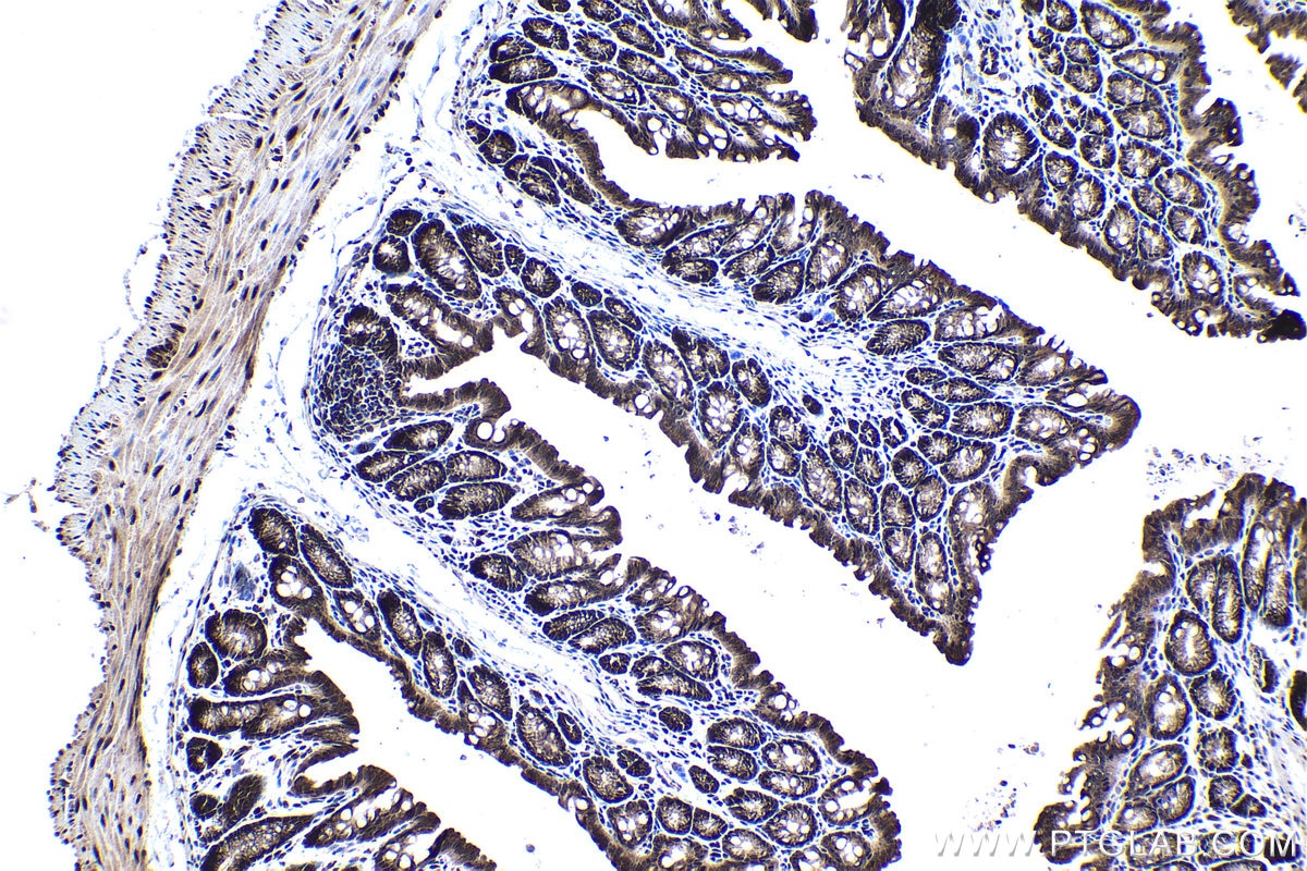 Immunohistochemical analysis of paraffin-embedded mouse colon tissue slide using KHC1367 (MYCBP IHC Kit).