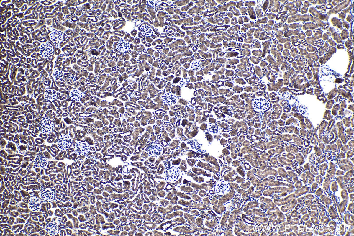 Immunohistochemical analysis of paraffin-embedded mouse kidney tissue slide using KHC1367 (MYCBP IHC Kit).