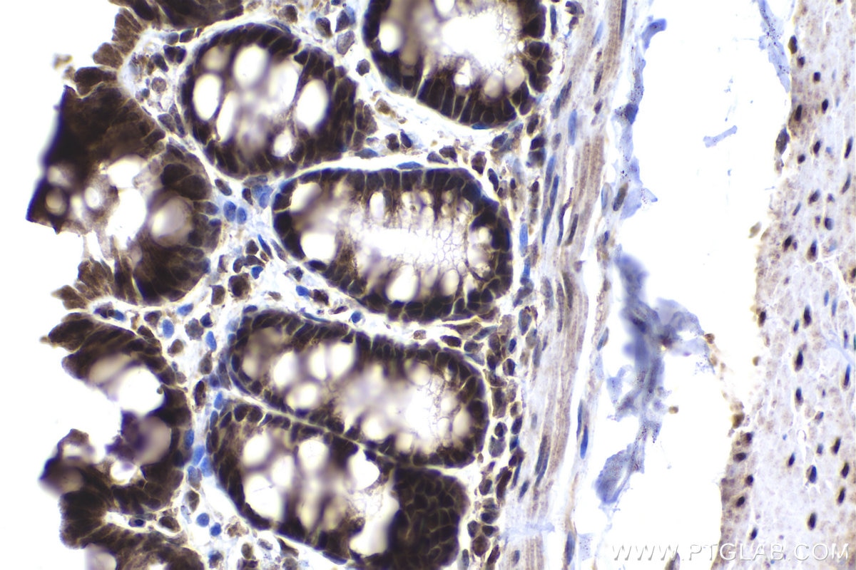 Immunohistochemical analysis of paraffin-embedded rat colon tissue slide using KHC1367 (MYCBP IHC Kit).