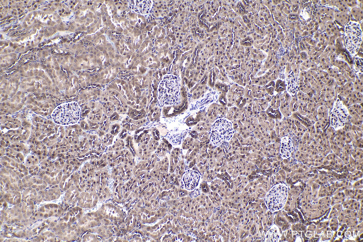 Immunohistochemical analysis of paraffin-embedded rat kidney tissue slide using KHC1367 (MYCBP IHC Kit).