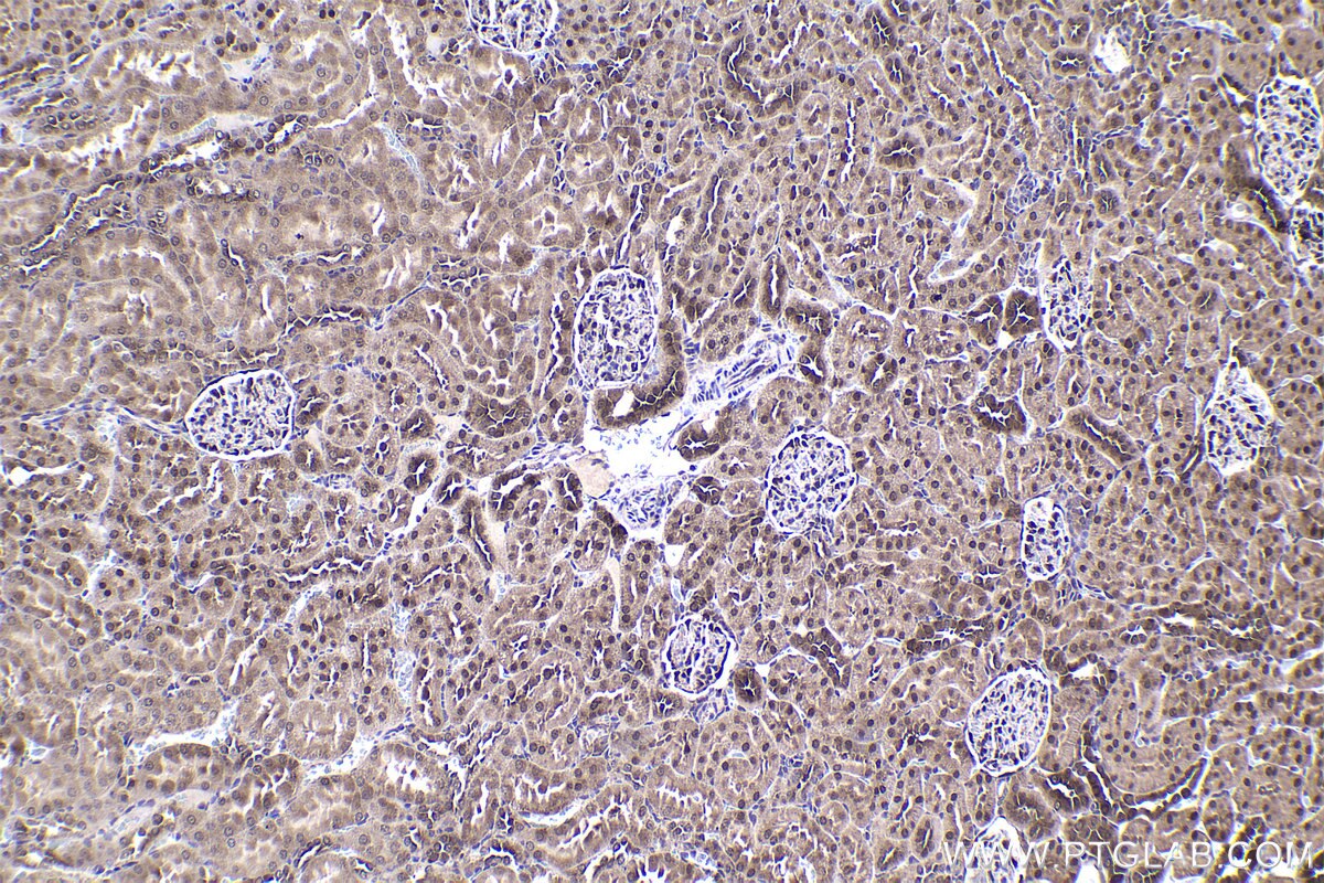 Immunohistochemical analysis of paraffin-embedded rat kidney tissue slide using KHC1367 (MYCBP IHC Kit).