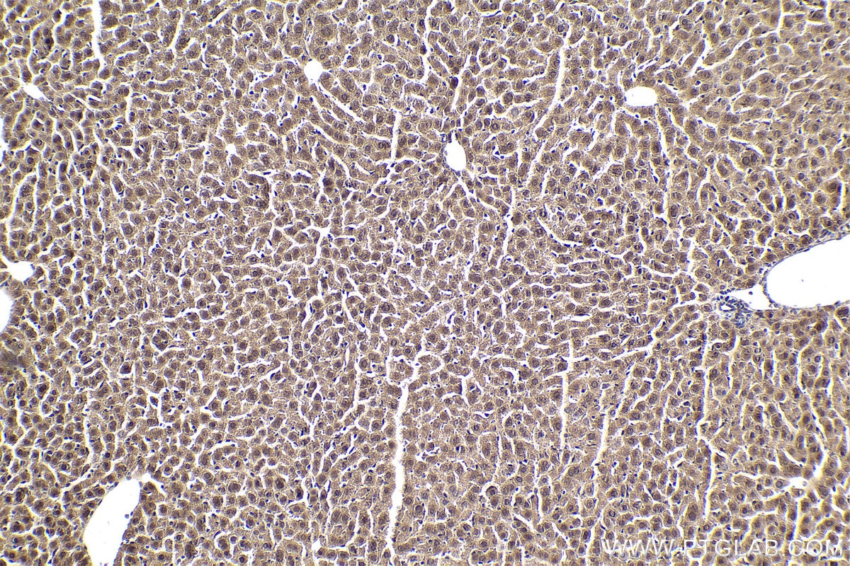 Immunohistochemical analysis of paraffin-embedded mouse liver tissue slide using KHC1924 (MYD88 IHC Kit).
