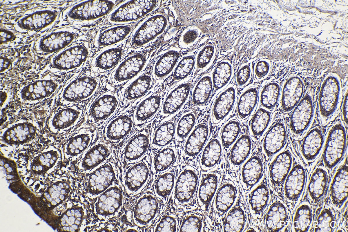 Immunohistochemical analysis of paraffin-embedded human colon tissue slide using KHC1139 (MYDGF IHC Kit).