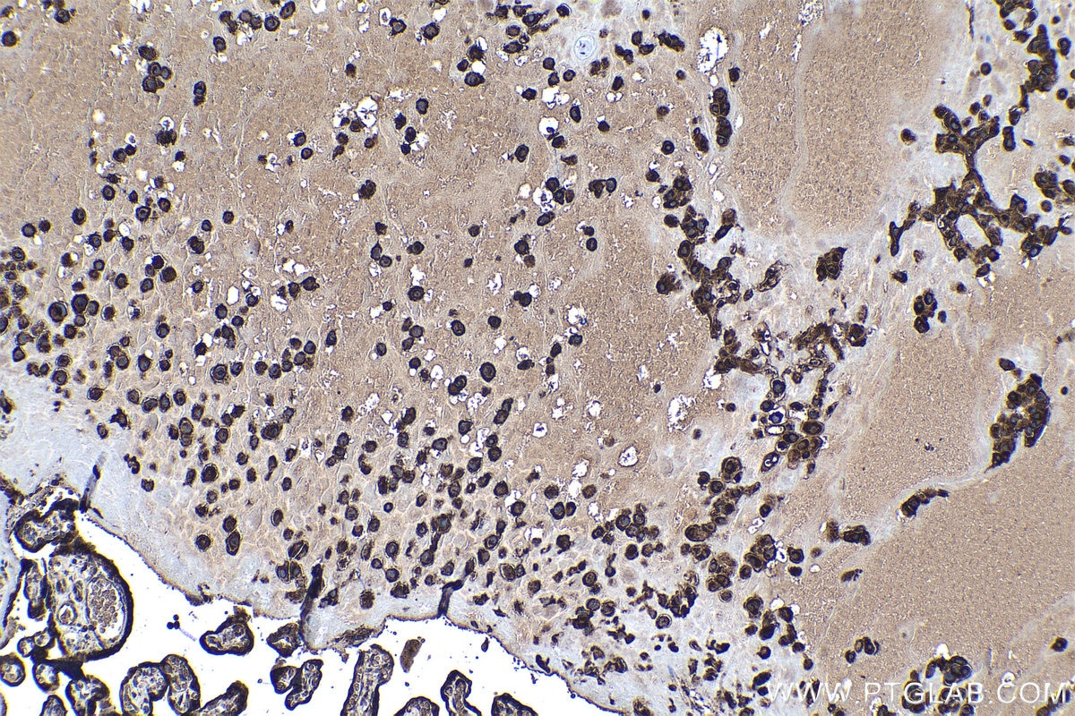 Immunohistochemical analysis of paraffin-embedded human placenta tissue slide using KHC1139 (MYDGF IHC Kit).