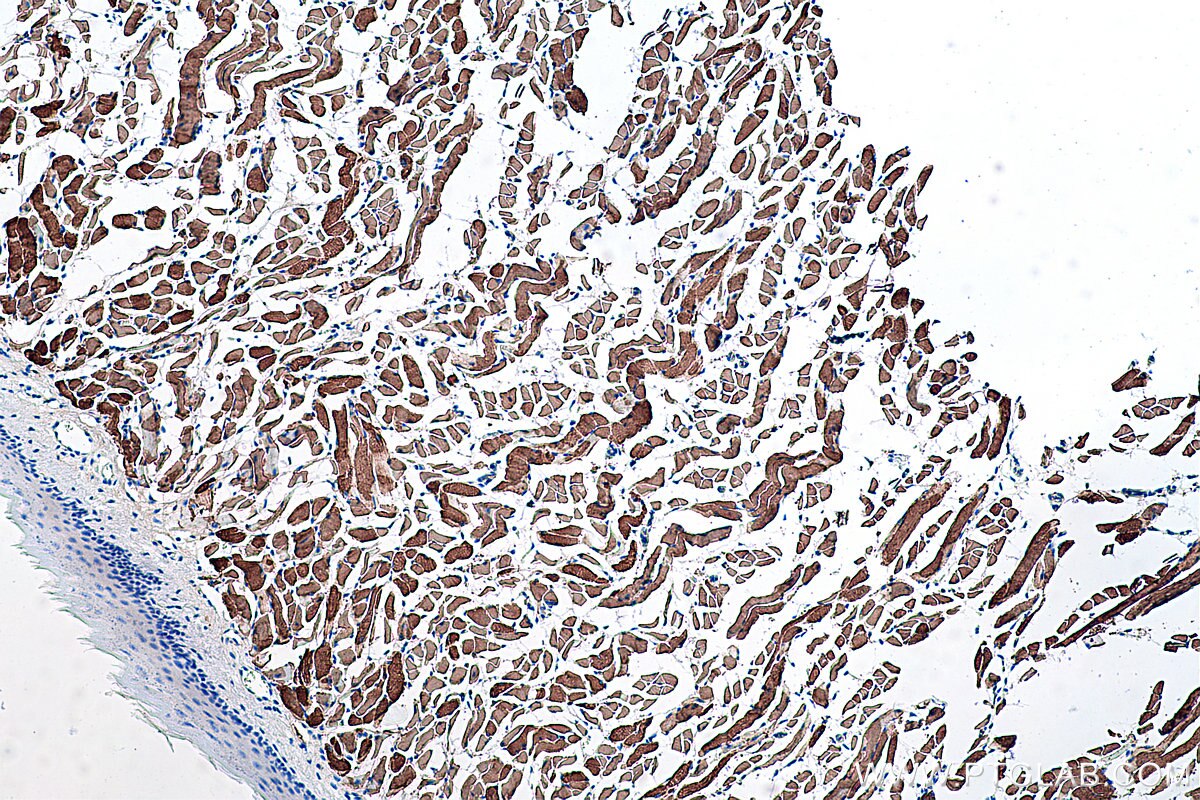 Immunohistochemical analysis of paraffin-embedded mouse tongue tissue slide using KHC0364 (MYH1 IHC Kit).