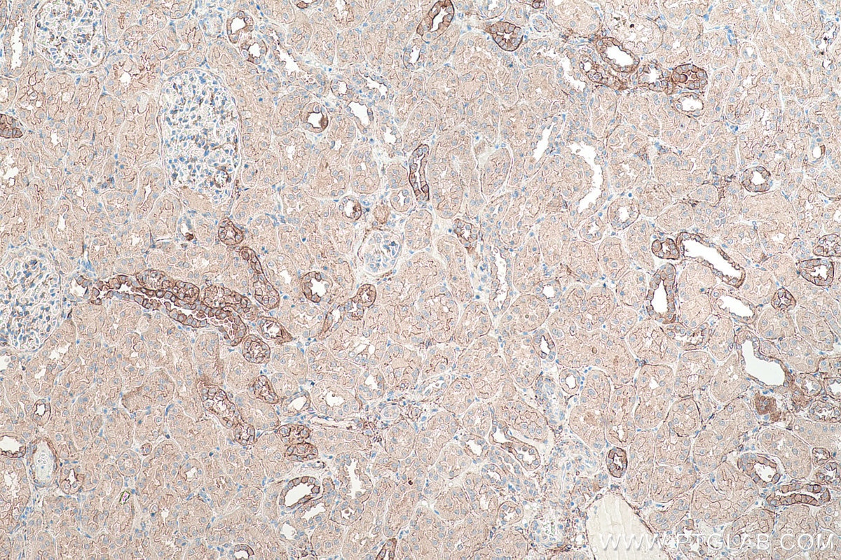 Immunohistochemical analysis of paraffin-embedded human kidney tissue slide using KHC0346 (MYH10 IHC Kit).