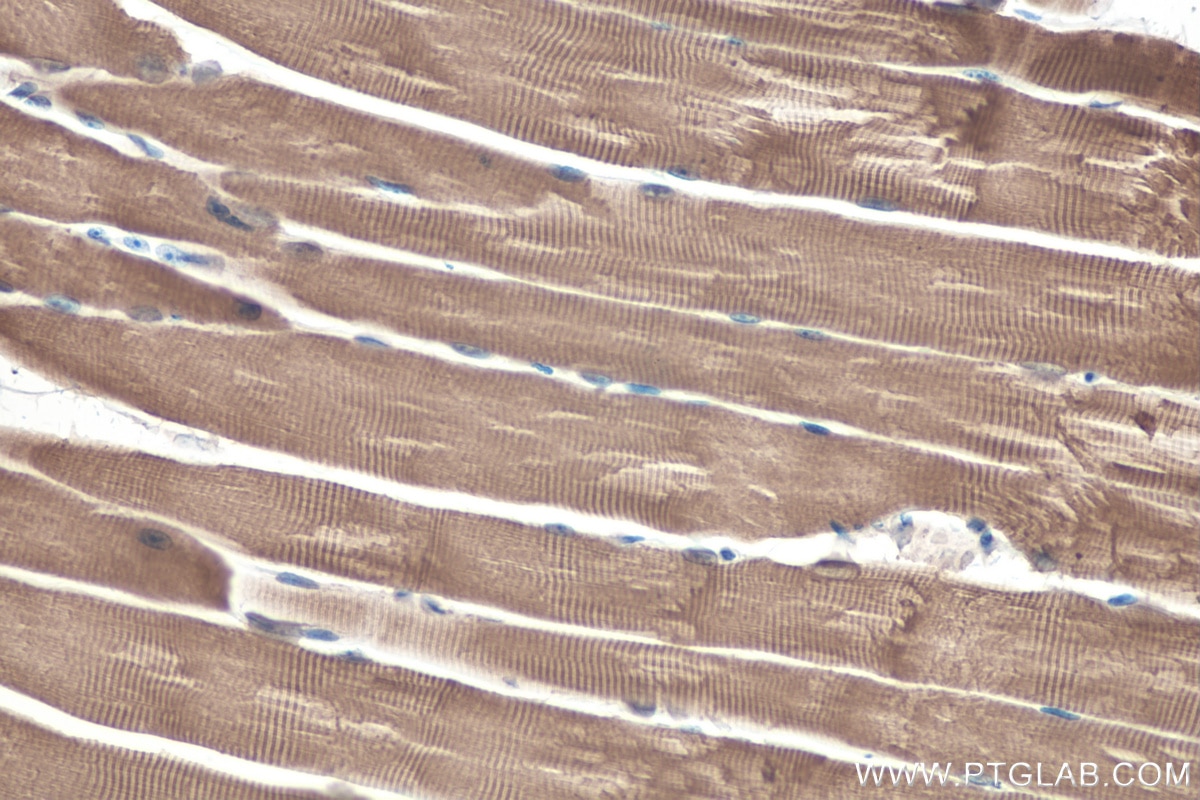 Immunohistochemical analysis of paraffin-embedded mouse skeletal muscle tissue slide using KHC0350 (MYH13 IHC Kit).