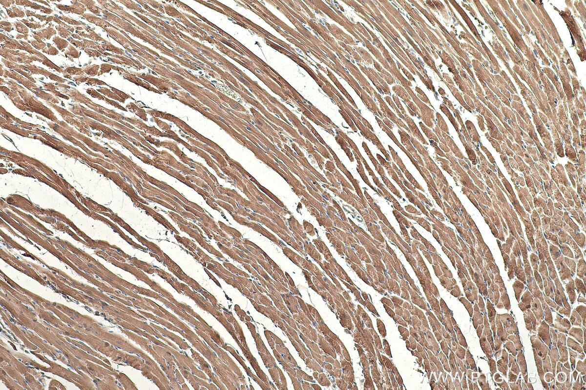 Immunohistochemical analysis of paraffin-embedded mouse heart tissue slide using KHC0350 (MYH13 IHC Kit).