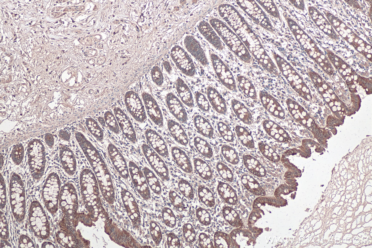 Immunohistochemical analysis of paraffin-embedded human colon tissue slide using KHC0351 (MYH14 IHC Kit).