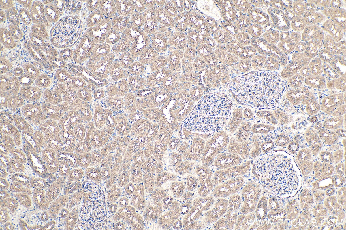 Immunohistochemical analysis of paraffin-embedded human kidney tissue slide using KHC0351 (MYH14 IHC Kit).