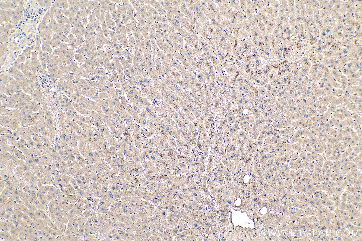 Immunohistochemical analysis of paraffin-embedded human liver tissue slide using KHC0351 (MYH14 IHC Kit).