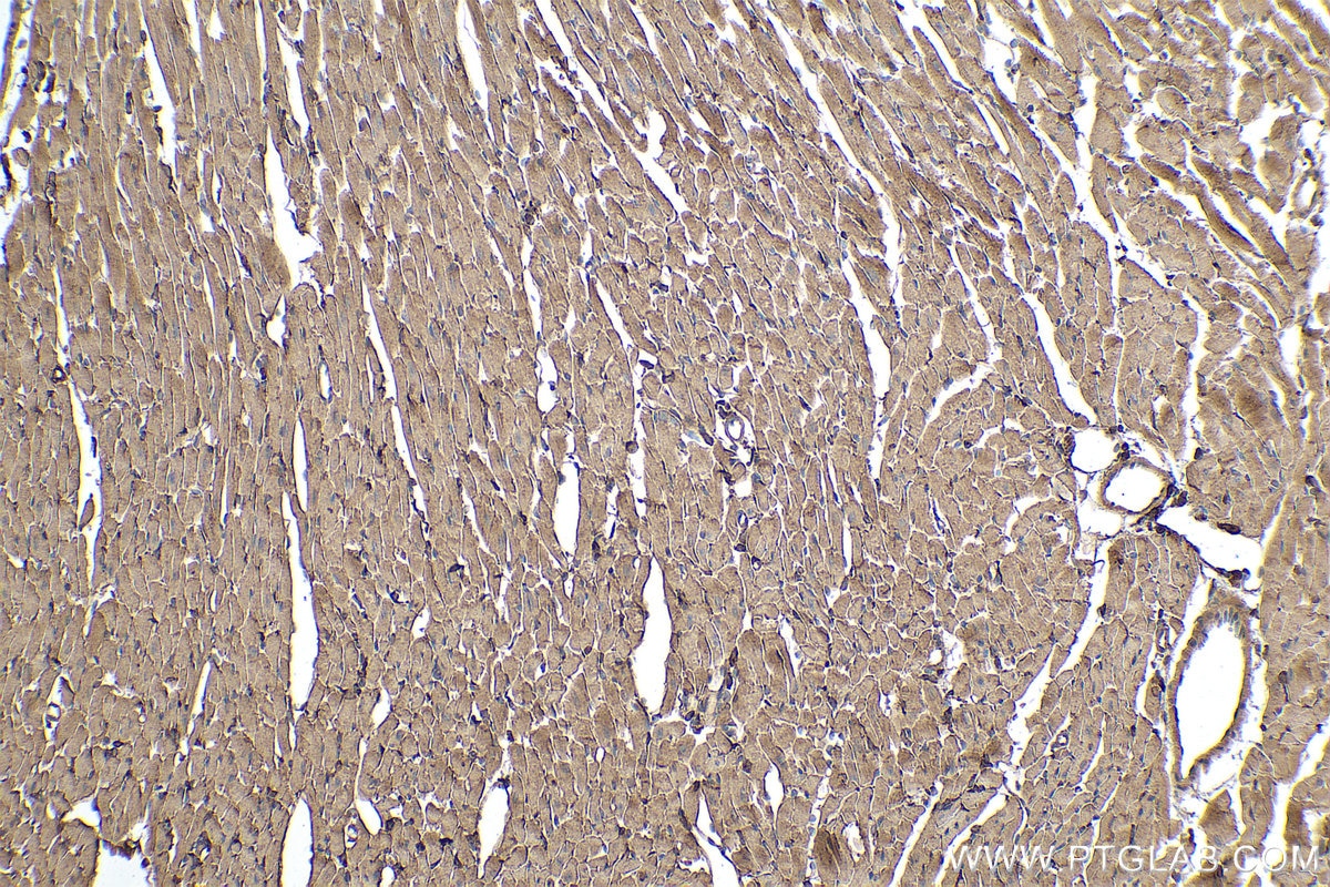 Immunohistochemical analysis of paraffin-embedded mouse heart tissue slide using KHC0351 (MYH14 IHC Kit).