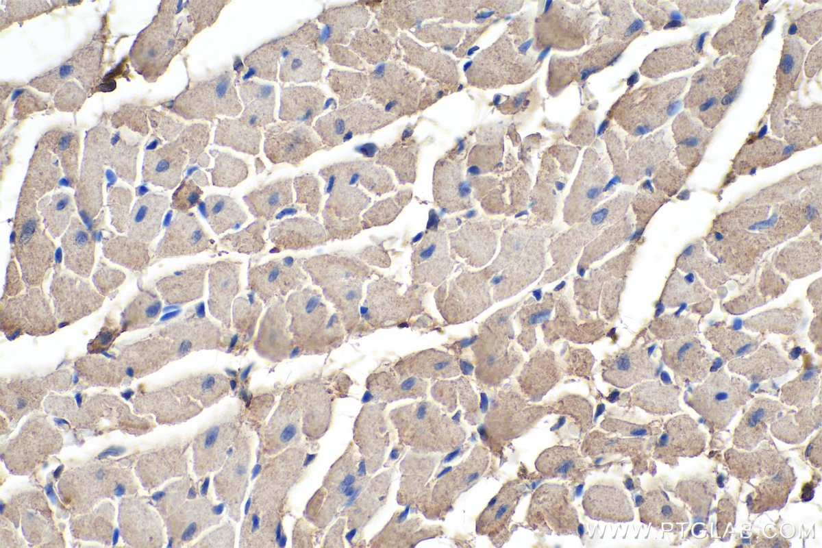 Immunohistochemical analysis of paraffin-embedded rat heart tissue slide using KHC0351 (MYH14 IHC Kit).