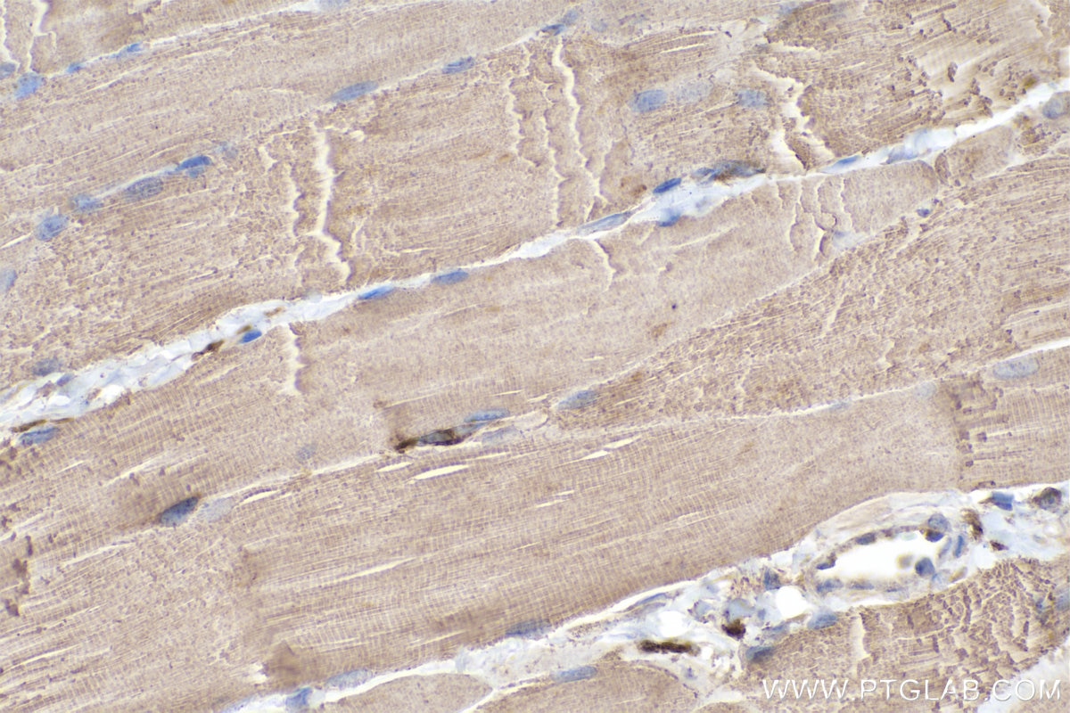 Immunohistochemical analysis of paraffin-embedded rat skeletal muscle tissue slide using KHC0351 (MYH14 IHC Kit).