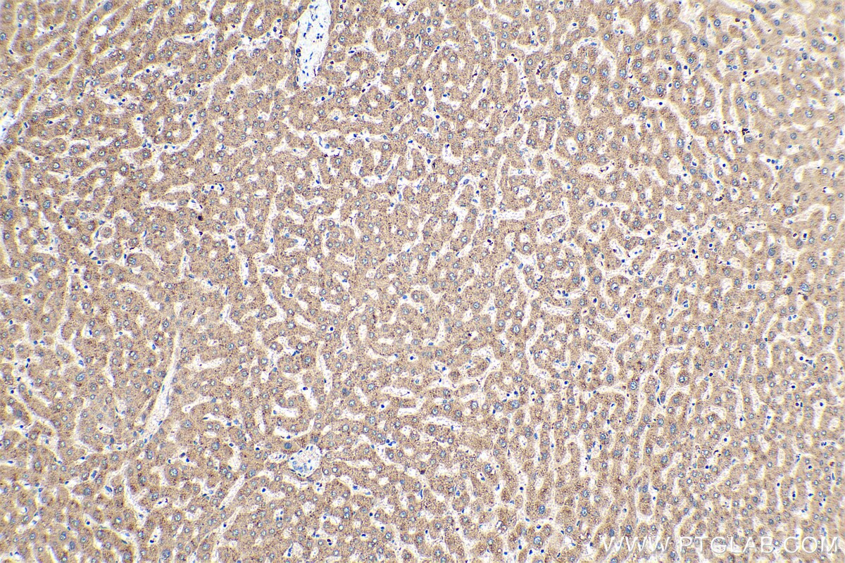 Immunohistochemical analysis of paraffin-embedded human liver tissue slide using KHC0352 (MYH15 IHC Kit).