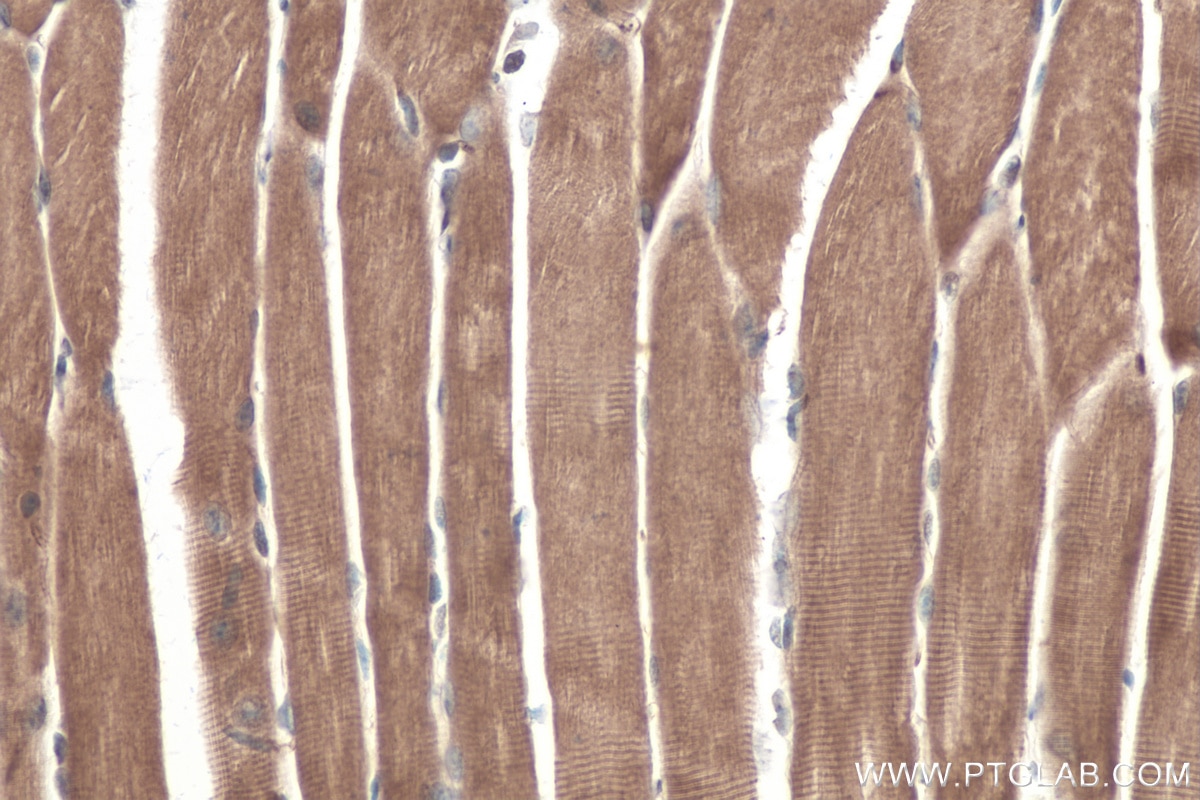 Immunohistochemical analysis of paraffin-embedded mouse skeletal muscle tissue slide using KHC0352 (MYH15 IHC Kit).