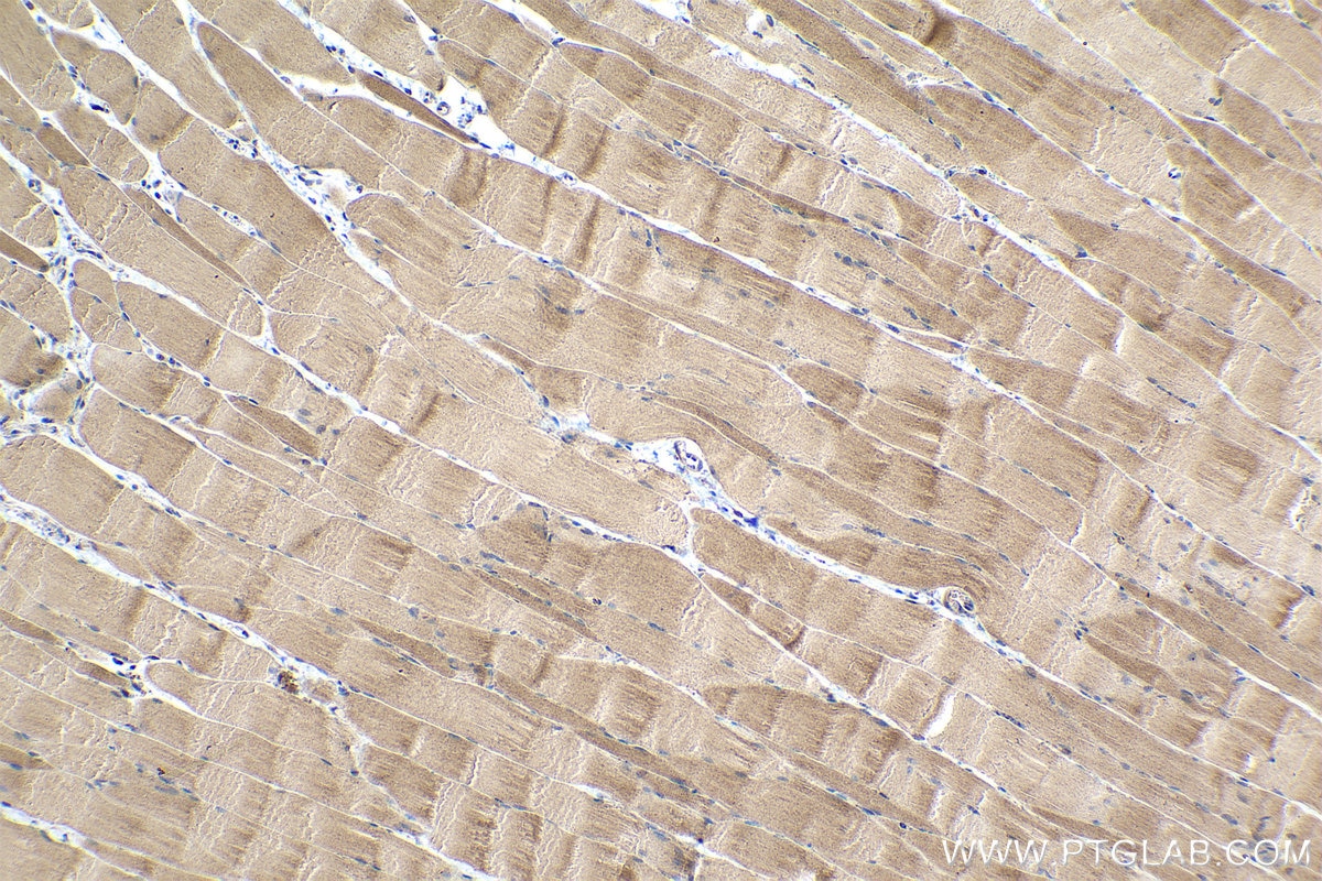 Immunohistochemical analysis of paraffin-embedded rat skeletal muscle tissue slide using KHC0352 (MYH15 IHC Kit).