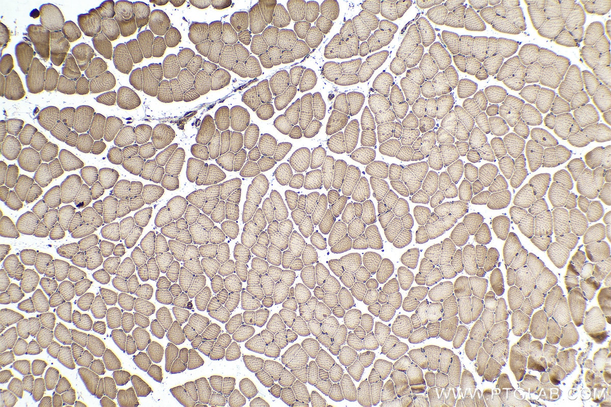 Immunohistochemical analysis of paraffin-embedded mouse skeletal muscle tissue slide using KHC0337 (MYH3 IHC Kit).