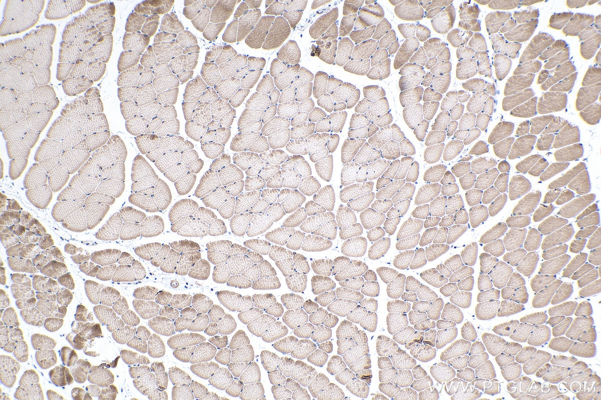 Immunohistochemical analysis of paraffin-embedded mouse skeletal muscle tissue slide using KHC0339 (MYH4 IHC Kit).