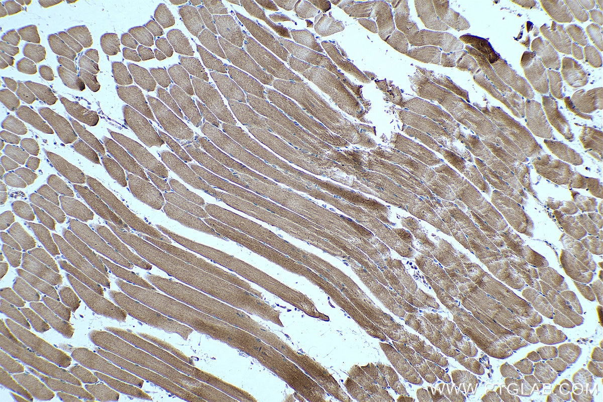 Immunohistochemical analysis of paraffin-embedded mouse skeletal muscle tissue slide using KHC0343 (MYH7 IHC Kit).