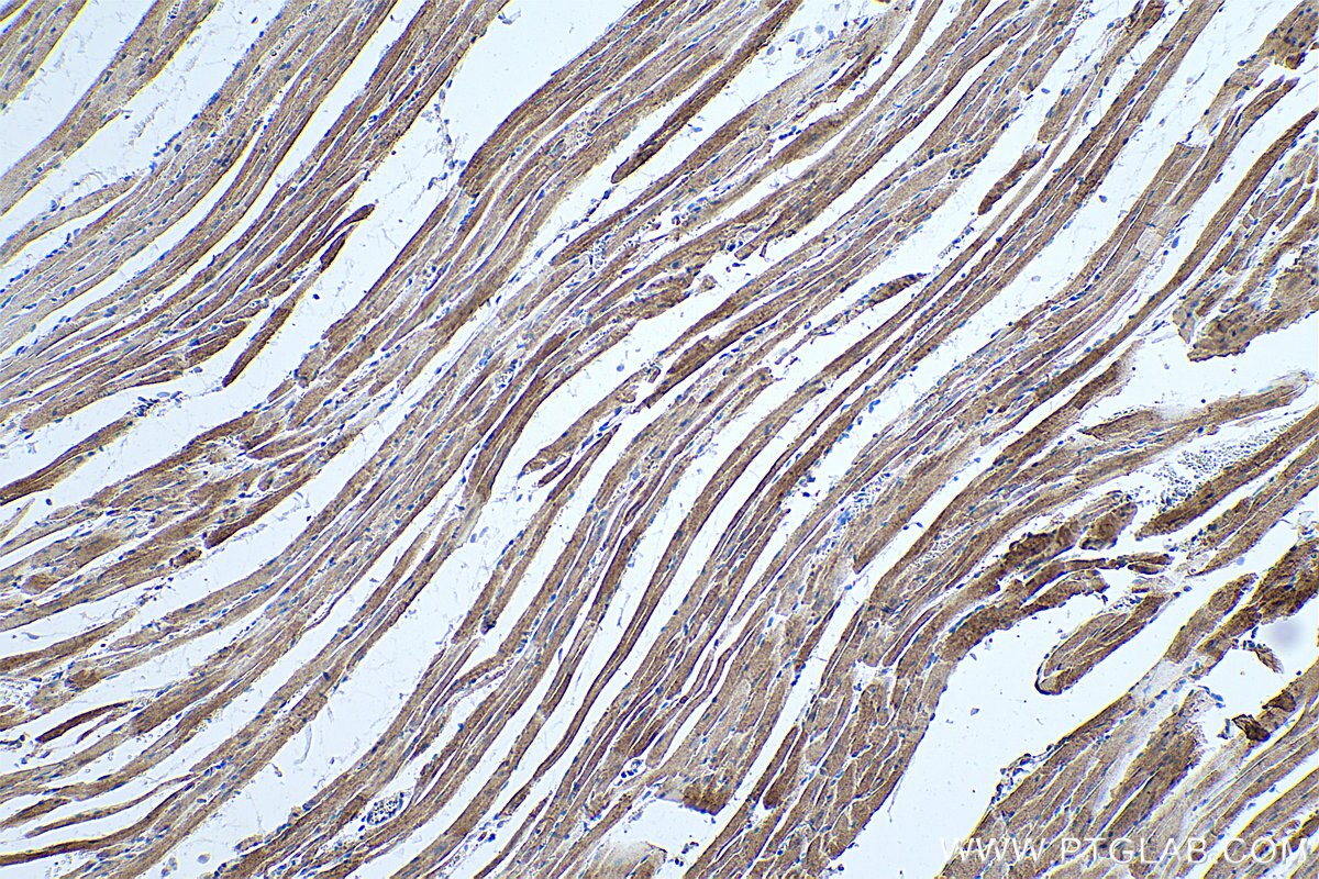 Immunohistochemical analysis of paraffin-embedded rat heart tissue slide using KHC0343 (MYH7 IHC Kit).