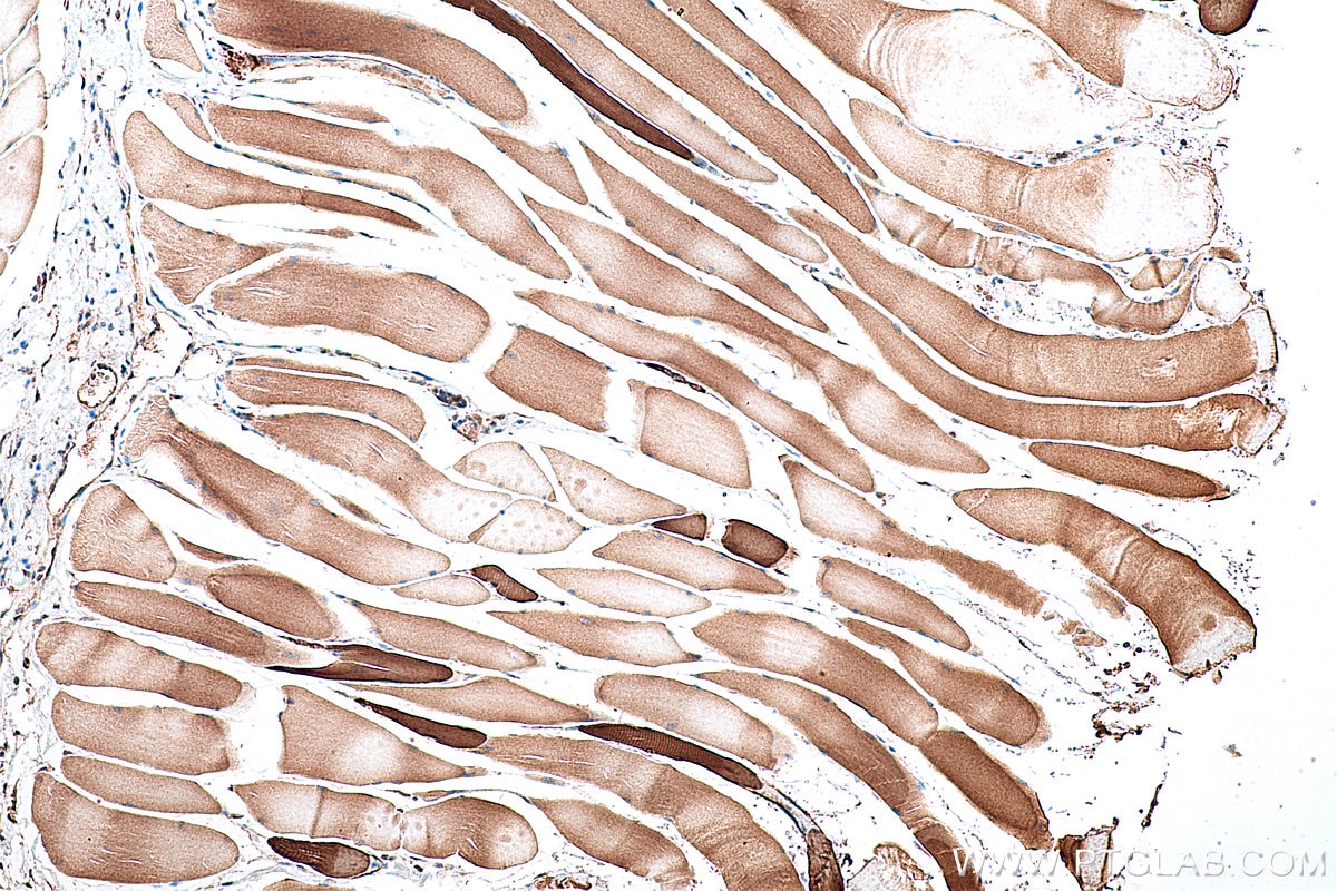 Immunohistochemical analysis of paraffin-embedded rat skeletal muscle tissue slide using KHC0343 (MYH7 IHC Kit).