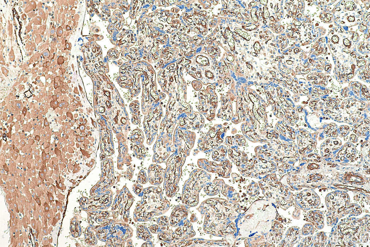 Immunohistochemical analysis of paraffin-embedded human placenta tissue slide using KHC0365 (MYH9 IHC Kit).