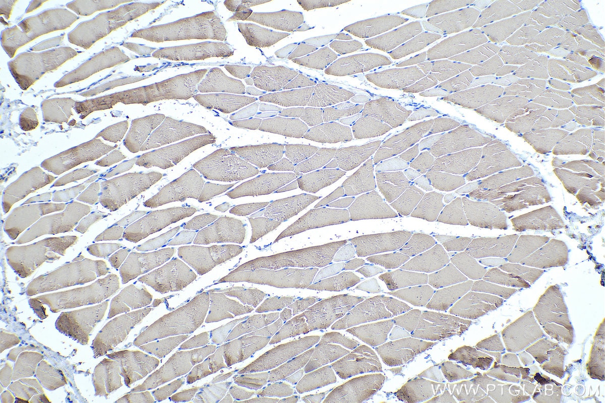 Immunohistochemical analysis of paraffin-embedded rat skeletal muscle tissue slide using KHC0335 (MYL1 IHC Kit).
