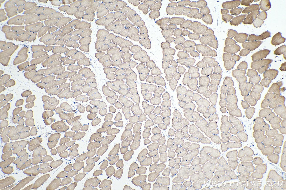 Immunohistochemical analysis of paraffin-embedded mouse skeletal muscle tissue slide using KHC0335 (MYL1 IHC Kit).