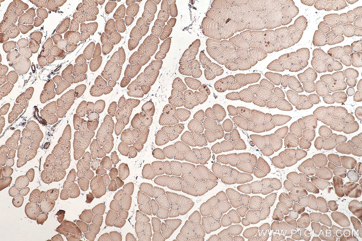 Immunohistochemical analysis of paraffin-embedded mouse skeletal muscle tissue slide using KHC0347 (MYL10 IHC Kit).