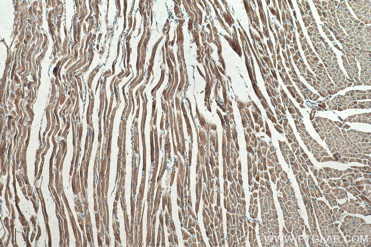 Immunohistochemical analysis of paraffin-embedded mouse heart tissue slide using KHC0347 (MYL10 IHC Kit).