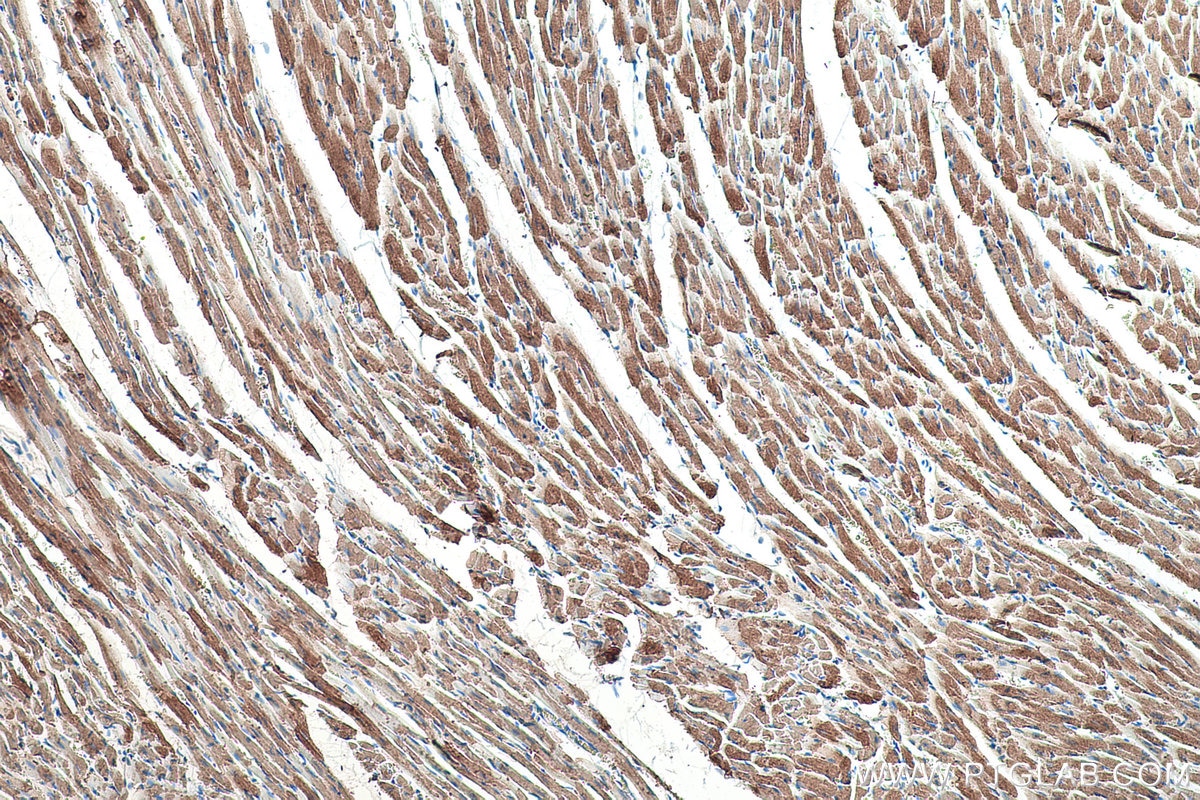 Immunohistochemical analysis of paraffin-embedded rat heart tissue slide using KHC0347 (MYL10 IHC Kit).