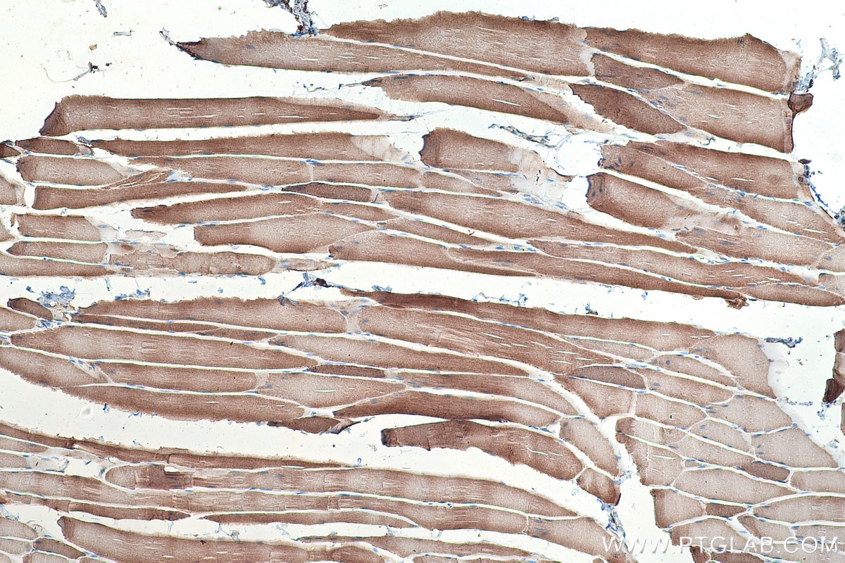 Immunohistochemical analysis of paraffin-embedded rat skeletal muscle tissue slide using KHC0347 (MYL10 IHC Kit).